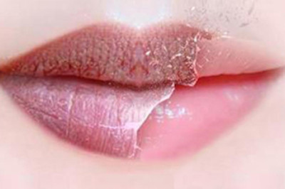 💗💗 Is Lip Balm Really Works to Make Lips Naturally Healthy and Pink? 💋💋